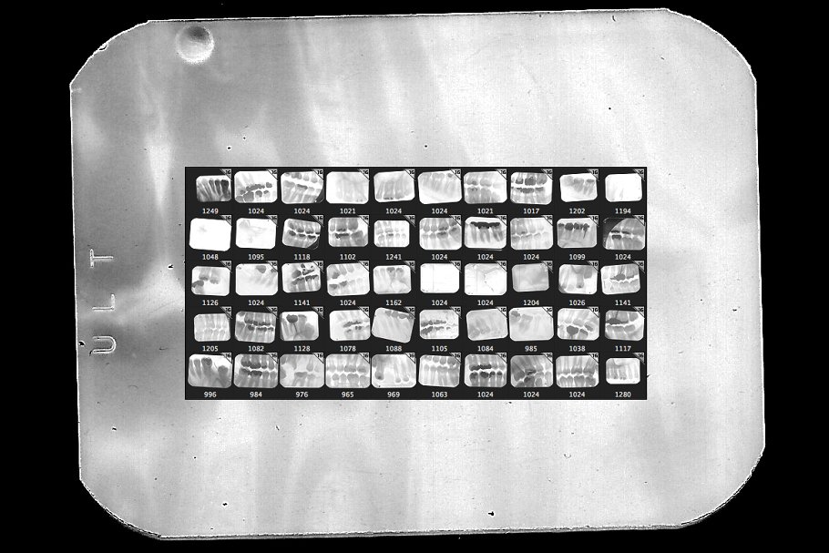 牙科X光射线影像PS笔刷 Dental X-ray Brushes插图(1)